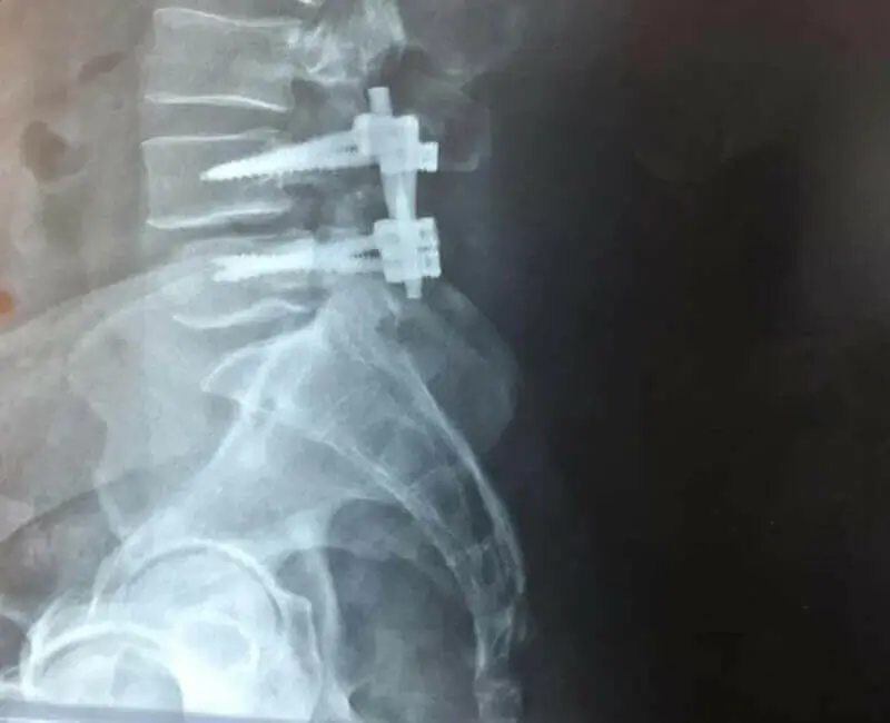 Artroscopia de rodilla - Tecnología avanzada